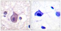 CD4 (phospho Ser433) Polyclonal Antibody