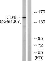 CD45 (phospho Ser1007) Polyclonal Antibody