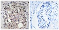 Cdc25A (phospho Ser178) Polyclonal Antibody