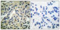 Cdc25B (phospho Ser323) Polyclonal Antibody