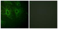 Hck (phospho Tyr410) Polyclonal Antibody
