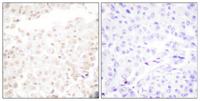 Cdk2/Cdc2 (phospho Thr160) Polyclonal Antibody