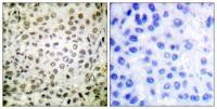 Cdk2/Cdc2 (phospho Thr160) Polyclonal Antibody