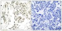Chk1 (phospho Ser345) Polyclonal Antibody