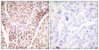 Chk2 (phospho Thr387) Polyclonal Antibody