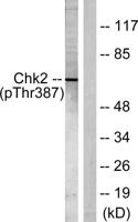 Chk2 (phospho Thr387) Polyclonal Antibody