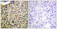 c-Kit (phospho Tyr703) Polyclonal Antibody