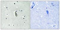 c-Kit (phospho Tyr936) Polyclonal Antibody