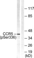 CKR-5 (phospho Ser336) Polyclonal Antibody