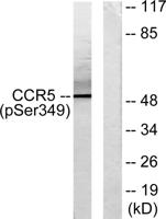 CKR-5 (phospho Ser349) Polyclonal Antibody