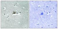 Claudin-5 (phospho Tyr217) Polyclonal Antibody