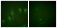 c-Myc (phospho Ser62) Polyclonal Antibody