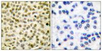 c-Myc (phospho Ser62) Polyclonal Antibody