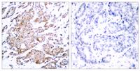 c-Myc (phospho Thr58) Polyclonal Antibody
