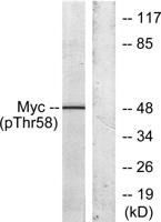 c-Myc (phospho Thr58) Polyclonal Antibody