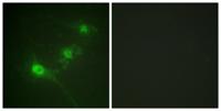 LKB1 (phospho Ser428) Polyclonal Antibody