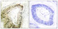 LKB1 (phospho Ser428) Polyclonal Antibody