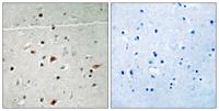 LIMK-2 (phospho Ser283) Polyclonal Antibody
