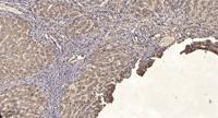 Lck BP-1 (phospho Tyr397) Polyclonal Antibody