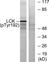Lck (phospho Tyr192) Polyclonal Antibody