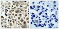HDAC8 (phospho Ser39) Polyclonal Antibody