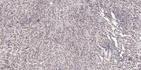 SCG10 (phospho Ser73) Polyclonal Antibody