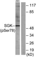 SGK1 (phospho Ser78) Polyclonal Antibody