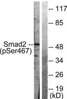 Smad2 (phospho Ser467) Polyclonal Antibody
