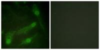 Smad2 (phospho Thr220) Polyclonal Antibody