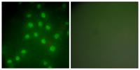 Histone deacetylase 9 Polyclonal Antibody