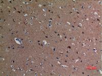 Tubulin α (Acetyl Lys40) Polyclonal Antibody