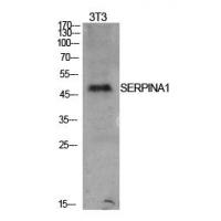 AAT Polyclonal Antibody