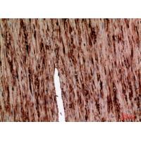 AAT Polyclonal Antibody