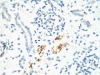 Kif 7 Monoclonal Antibody(3F8)