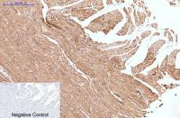Collagen III Monoclonal Antibody(Q76)