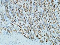 CD15 Monoclonal Antibody(Q89)