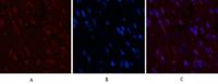 CD5 Monoclonal Antibody(10G8)