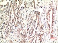 CHOP mouse Monoclonal Antibody(2B1)