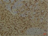 HIF-1 β/ARNT Monoclonal Antibody(4C5)