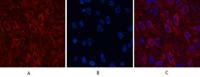 AMACR Monoclonal Antibody(4A12)