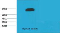 Transferrin Monoclonal Antibody(10G3)