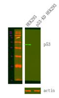 p53 Monoclonal Antibody(6C4)