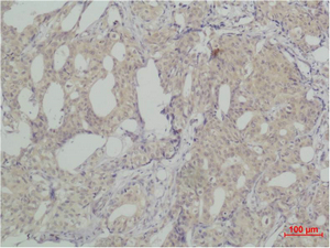 SLUG Polyclonal Antibody