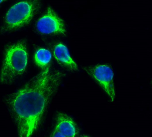 Tau Polyclonal Antibody