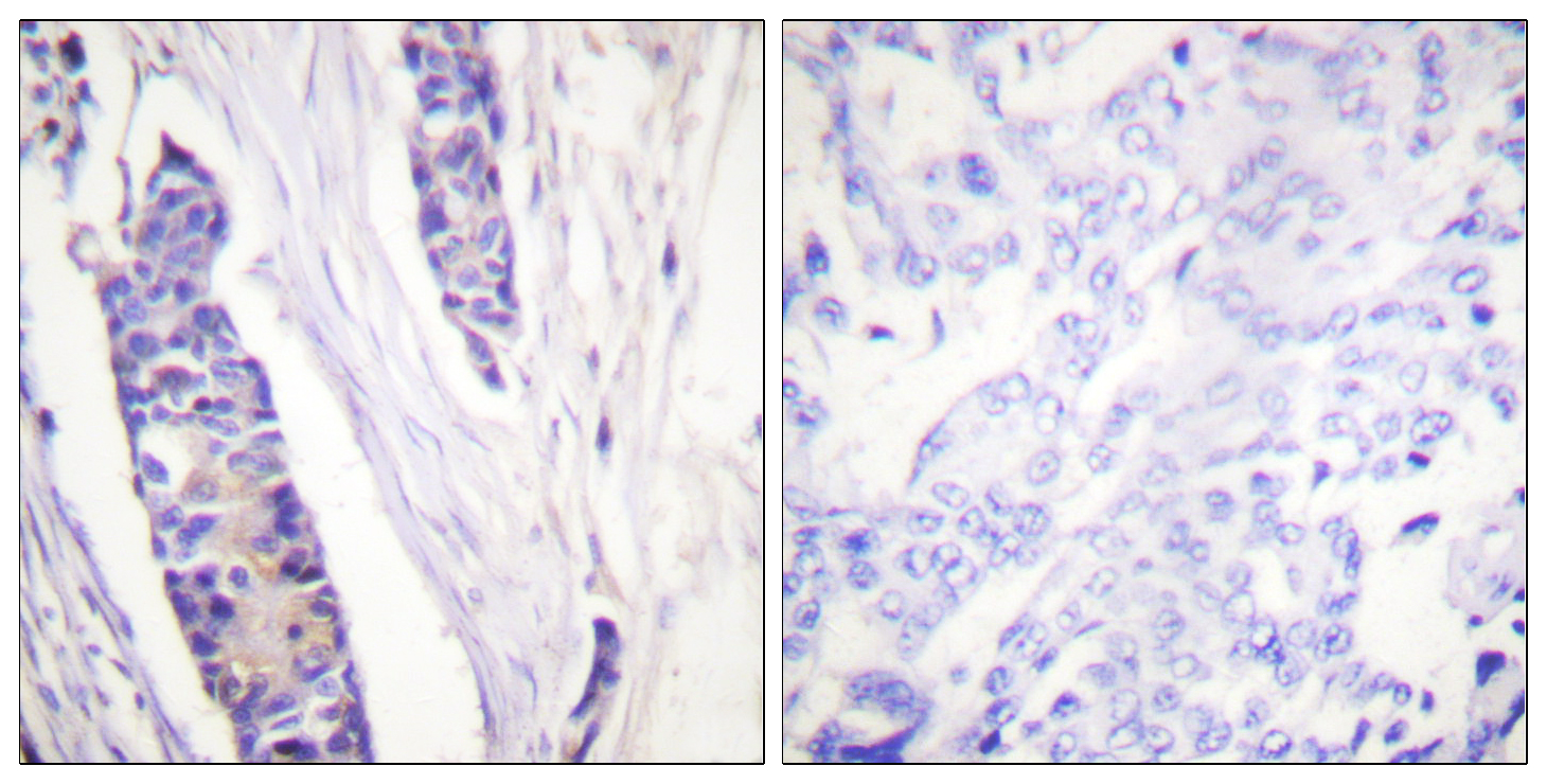Tubulin β Polyclonal Antibody