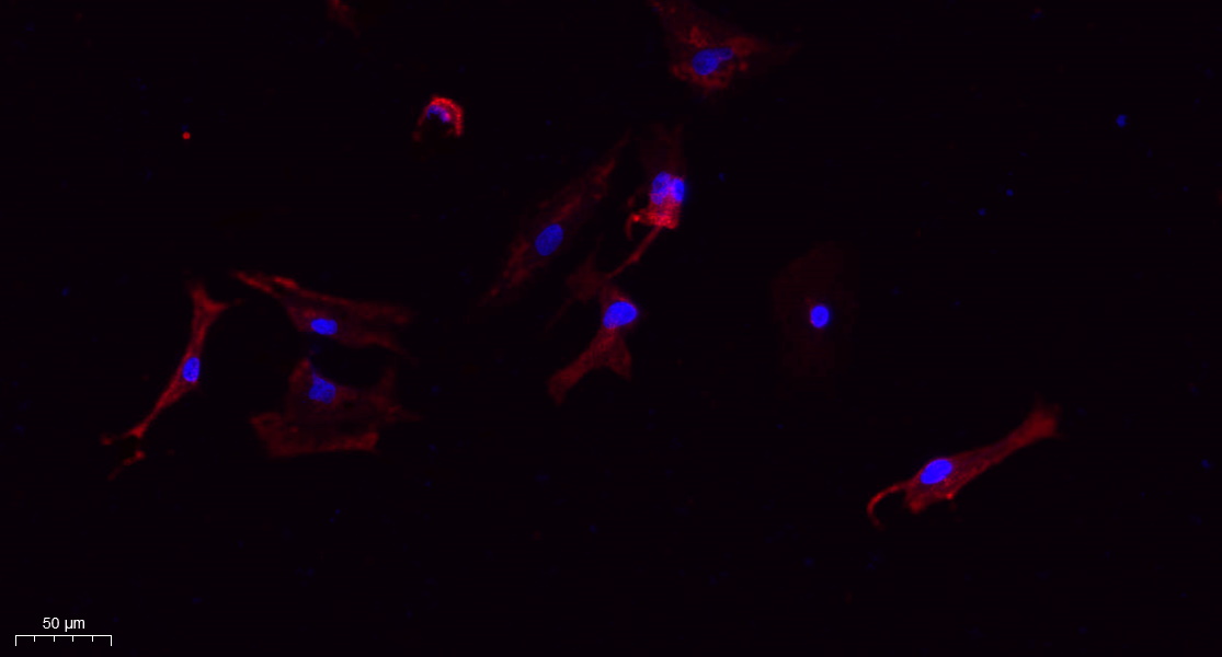 Tubulin β Polyclonal Antibody