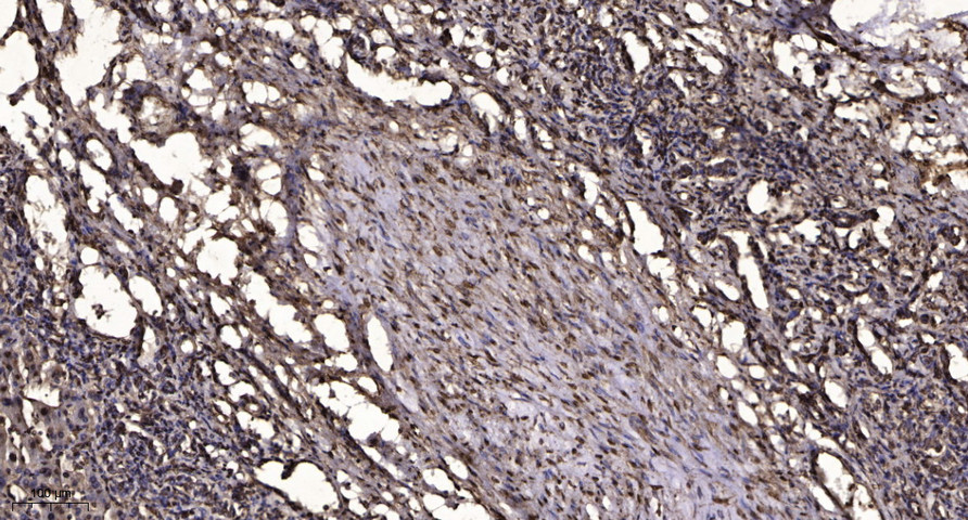 Caspase-8 Polyclonal Antibody