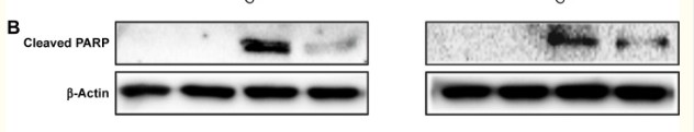 PARP-1 Polyclonal Antibody