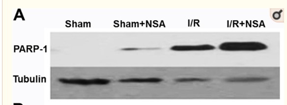 PARP-1 Polyclonal Antibody