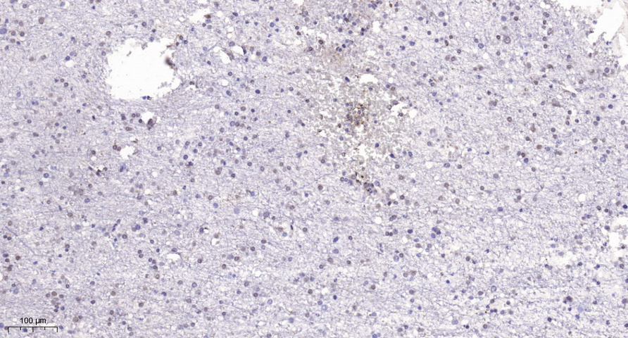 PARP-1 Polyclonal Antibody